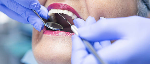 Best Urgent Care for Lost Fillings or Crowns in Fall River, MA